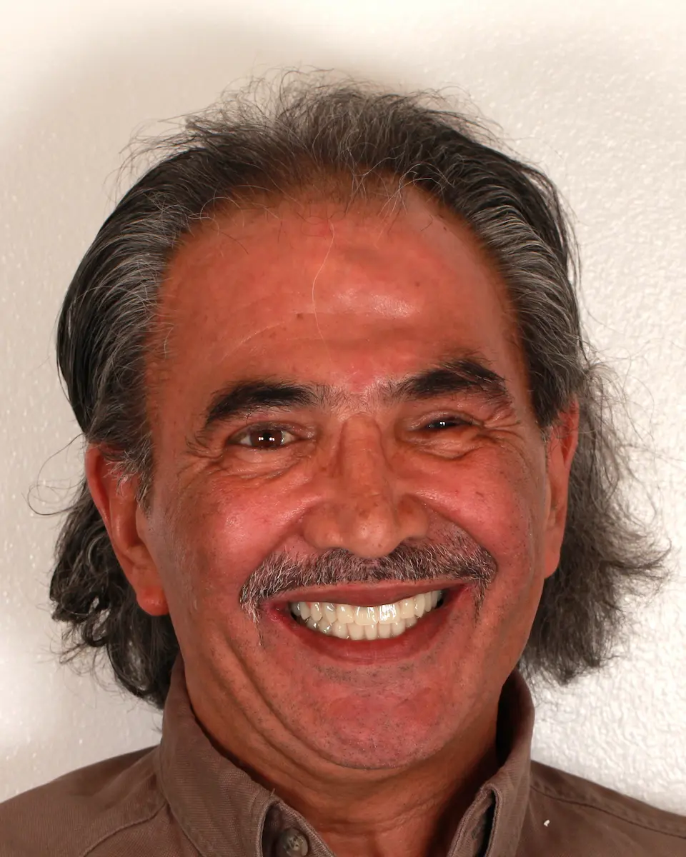 Cemil — Ergebnis nach All-on-6 und All-on-4