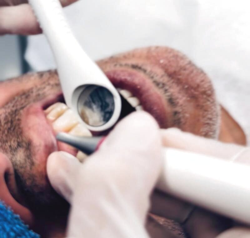 Prophylaxe bei Dr. Vogtner